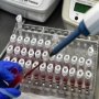 Москвичей с 15 мая начнут массово тестировать на антитела к коронавирусу
